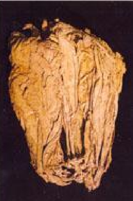 Dark Air Cured Virginia Tobacco (DAC)